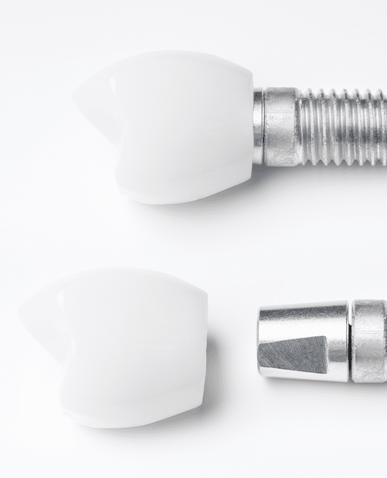 스마일 임플란트 진료 소개 이미지