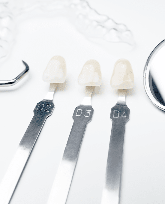 스마일 라미네이트 미백 진료 소개 이미지