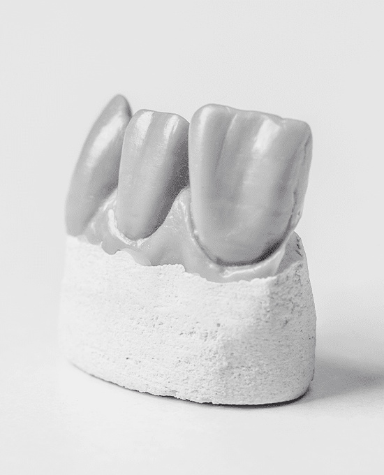 원데이 보철 진료 소개 이미지