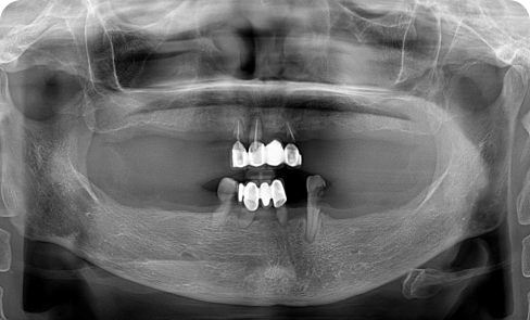 치료 전 임상 사례 1