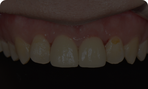 치료 후 임상 사례 2