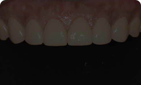 치료 후 임상 사례 3