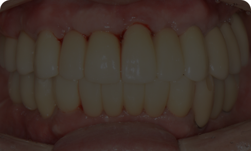 치료 후 임상 사례 4